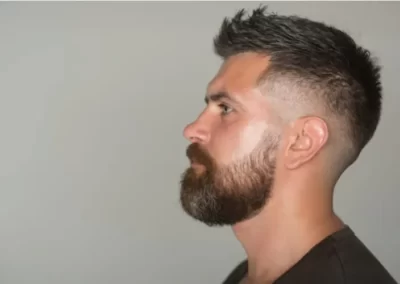 high fade image