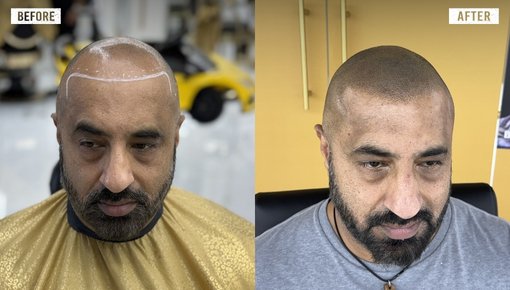 Blade head.jpg