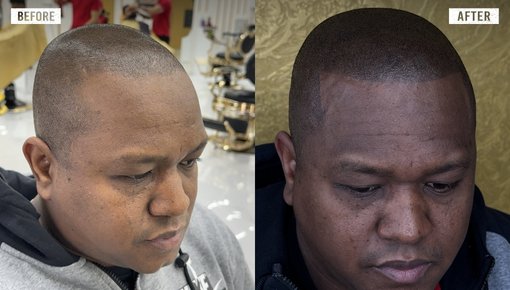 Hair Line 1.jpg
