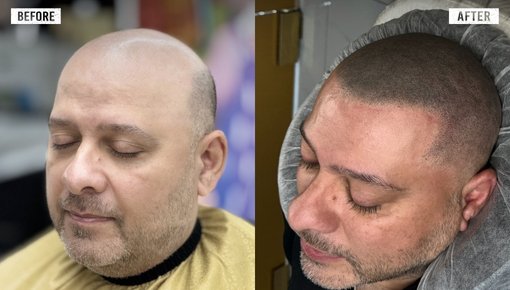 Hair Line.jpg